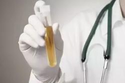 喝茶叶后可以查尿吗？