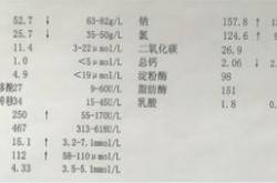 秦始皇的心理异常历史人物的心理障碍分析