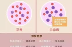 卵泡少能怀孕吗