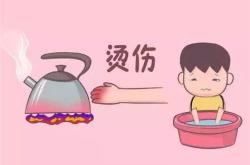 孩子烧伤用茶叶可以吗