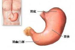 慢性浅表性胃炎饮食指导